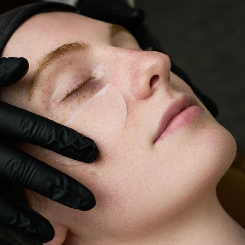 Using Corthe Collagen Gel Pads as a targeted hydrating mini-mask on the cheeks to soothe redness and restore skin elasticity.