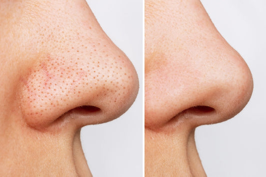 Unlock Glass Skin: The Ultimate Korean Double Cleanse Method