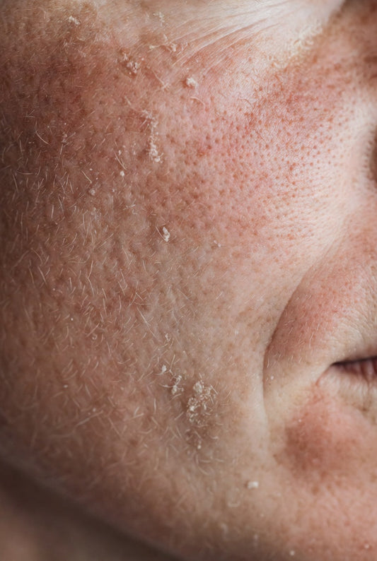 How to use Korean skincare to heal sensitive skin?