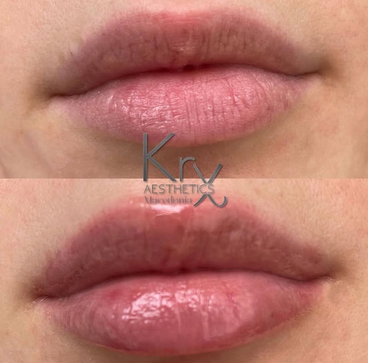 KrX Pocket Filler Lip Plumping Gloss