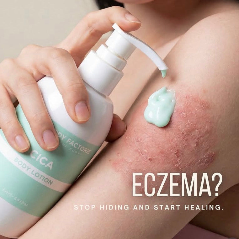 Fast-absorbing Cica body moisturizer for eczema-prone skin being applied to calm irritation and chronic dryness without a greasy residue.