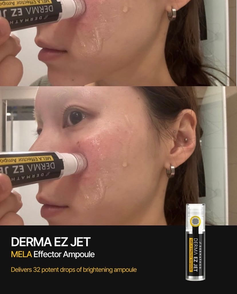 Why stamping is safer for melasma than derma rollers: Vertical entry prevents the heat and friction that can often worsen hormonal pigmentation.