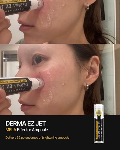 Why stamping is safer for melasma than derma rollers: Vertical entry prevents the heat and friction that can often worsen hormonal pigmentation.