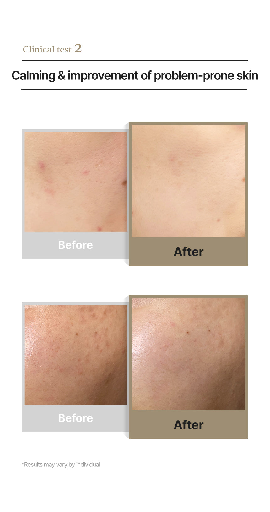 Clinical thermal care: An informational graphic explaining how Dermathod Soba Calm Cream lowers skin temperature to reduce inflammation and heat-induced sebum production.