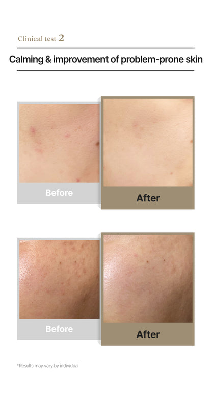 Clinical thermal care: An informational graphic explaining how Dermathod Soba Calm Cream lowers skin temperature to reduce inflammation and heat-induced sebum production.