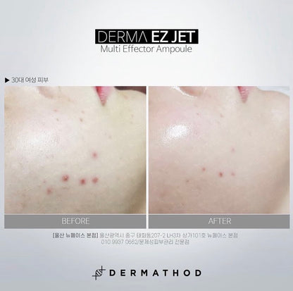 Before and after results of the Water Glow Kit showing increased skin density, plumpness, and a restored moisture barrier. Clinical Korean skincare.