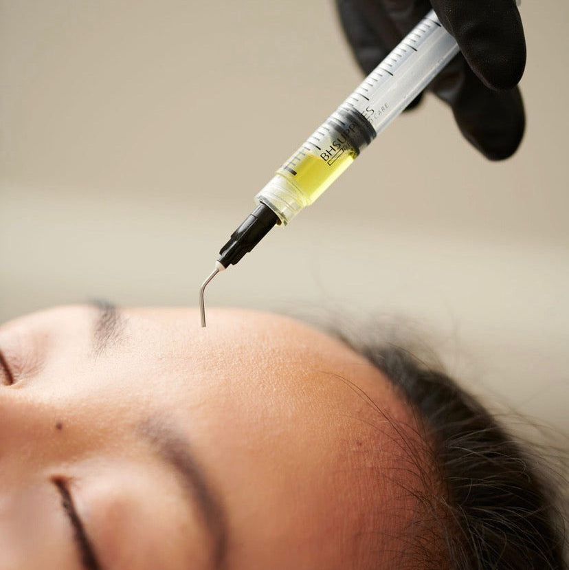 Korean Chemical Peel Treatments Near Meridian ID