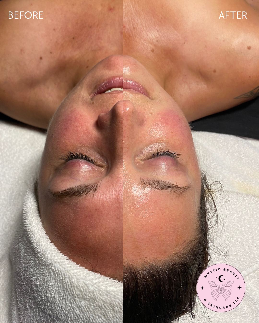 Redness calming facial results Boise licensed esthetician | Mystic Beauty & Korean skincare