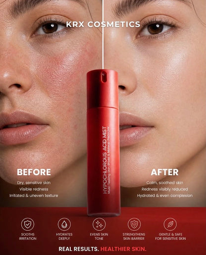 KrX Aesthetics Hypochlorous Acid Mist infographic highlighting anti-inflammatory benefits, microbiome protection, and green tea extract antioxidant defense.