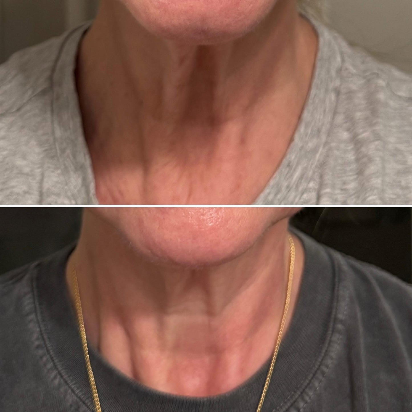 Shop KrX The Neck Lift Intensive Firming Neck Cream | Mystic Beauty