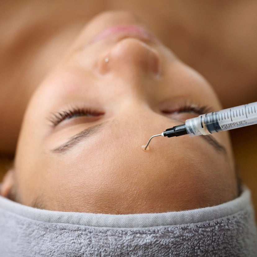 Professional Korean Microchanneling with PDRN (Salmon DNA) at Mystic Beauty & Skincare in Meridian, ID; a clinical regenerative facial for cellular repair, collagen density, and scar reduction.