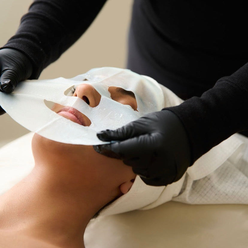 ProCell Microchanneling in Meridian, Idaho at Mystic Beauty & Skincare; a professional collagen-boosting treatment for acne scars and anti-aging near Boise.